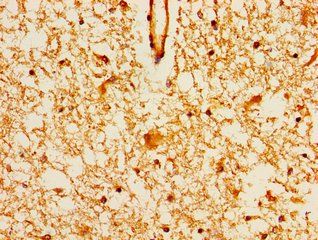 MAGI2 Antibody