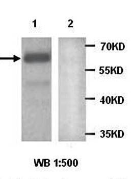 MAGI2 Rabbit Polyclonal Antibody