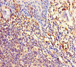 MAJIN Antibody