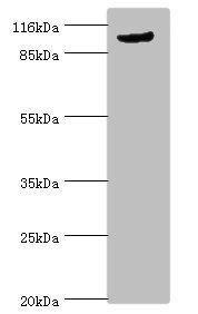 Major vault antibody