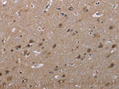 MAL Antibody