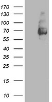 Malignant T cell amplified sequence 1 (MCTS1) antibody