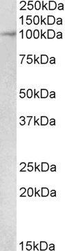 MALT1 antibody