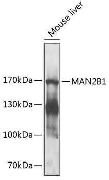 MAN2B1 antibody