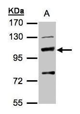STXBP2 Rabbit Polyclonal Antibody
