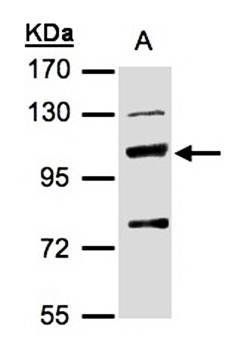 MANBA antibody