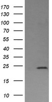 Mannose Phosphate Isomerase (MPI) antibody