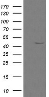 Mannose Phosphate Isomerase Antibody