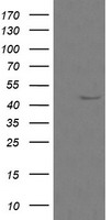 Mannose Phosphate Isomerase (MPI) antibody