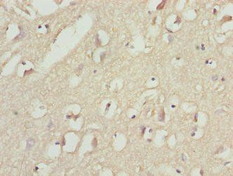 MAP1LC3A Antibody