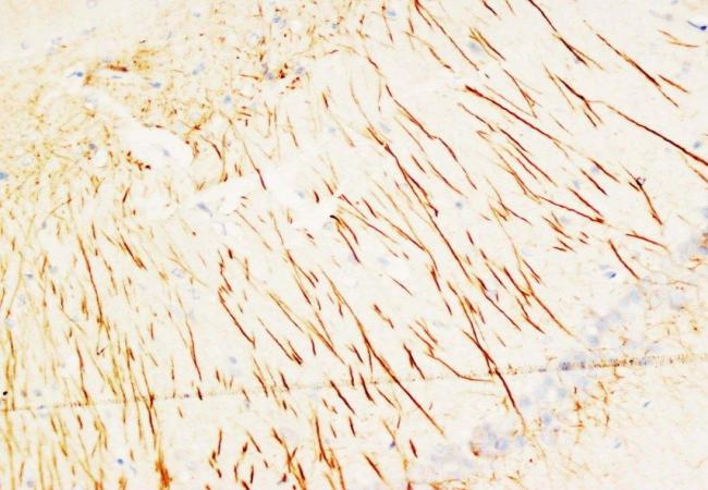 Anti-MAP2 Antibody (Monoclonal, HM-2)