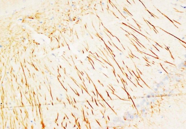 MAP2 Antibody (Monoclonal, HM-2)