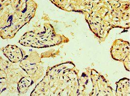MAP2K3 Antibody