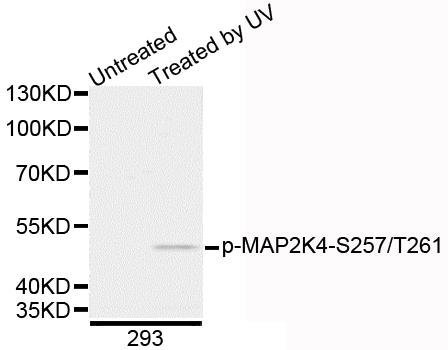 MAP2K4 (Phospho-S257/T261) antibody