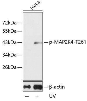 MAP2K4 (Phospho-T261) antibody