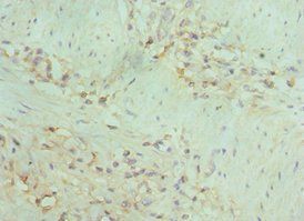 MAP2K5 Antibody