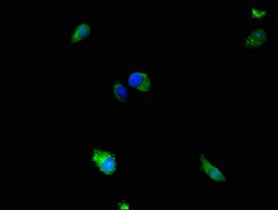 MAP2K5 Antibody