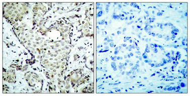 MAP2K6 (Ab-207) Antibody