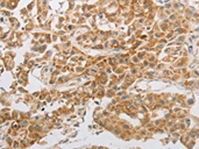 MAP2K6 Antibody