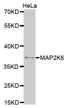 MAP2K6 antibody