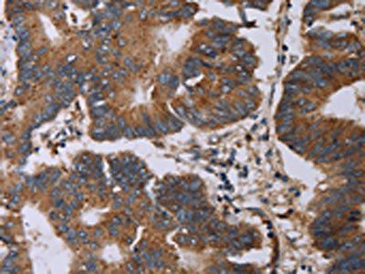 MAP3K11 Antibody