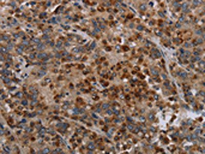 MAP3K11 Antibody