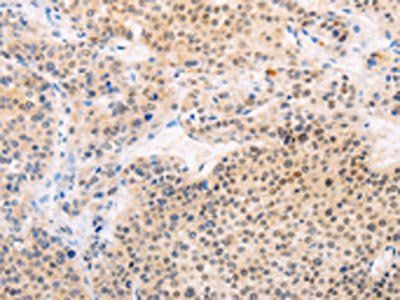 MAP3K12 Antibody