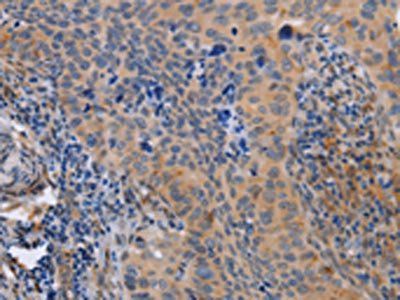 MAP3K13 Antibody