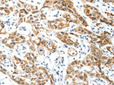 MAP3K14 Antibody