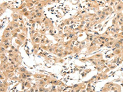 MAP3K14 Antibody
