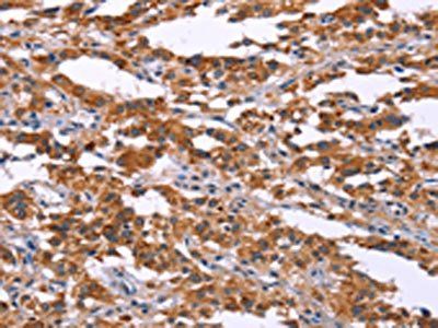 MAP3K2 Antibody