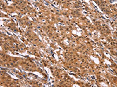 MAP3K2 Antibody