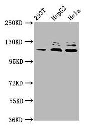 MAP3K21 antibody