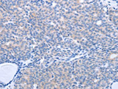 MAP3K4 Antibody