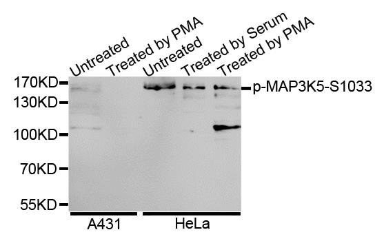 MAP3K5 (phospho-S1033) antibody