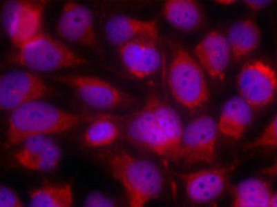 MAP3K5 (Ab-83) Antibody