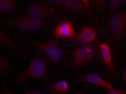 MAP3K5 (Ab-966) Antibody