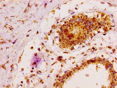 MAP3K6 Antibody