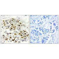 MAP3K6 Antibody