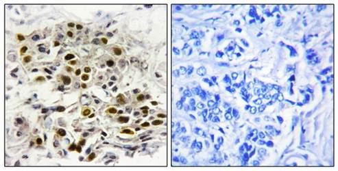 MAP3K6 Antibody