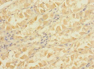 MAP3K7 Antibody