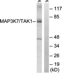MAP3K7 (Ab-187) Antibody