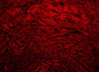 MAP3K7IP3 Rabbit Polyclonal Antibody