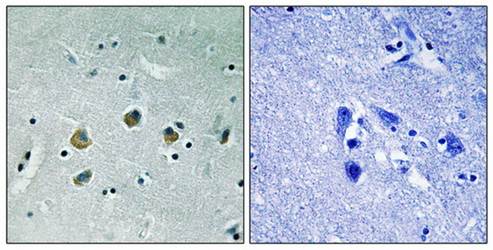 MAP3K8 (Phospho-Ser400) Antibody