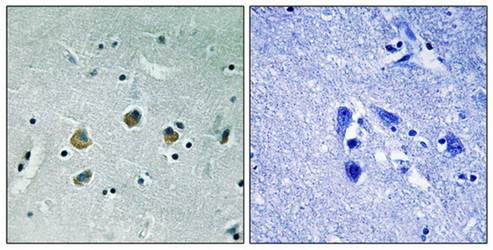 MAP3K8 (phospho-Ser400) antibody