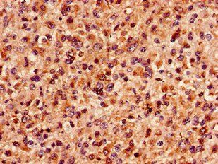 MAP4 Antibody