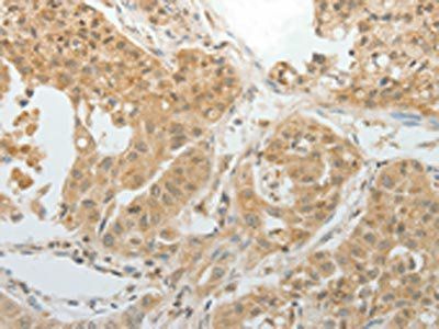 MAP4 Antibody