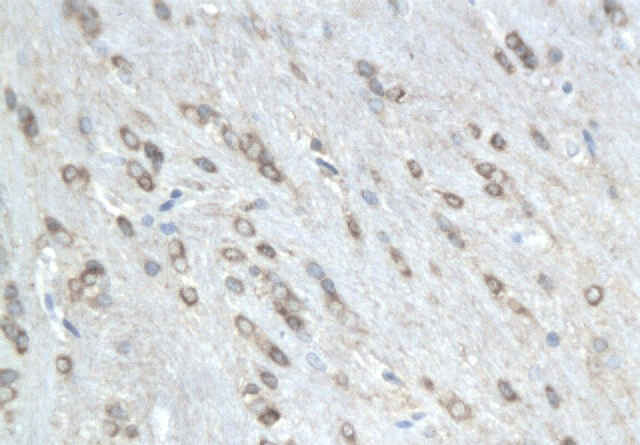 Phospho-MAP4 (Ser941) Rabbit Polyclonal Antibody