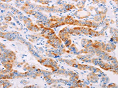 MAP4K3 Antibody