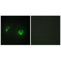 MAP4K4 Antibody